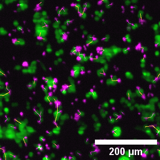 Zoomed contact analysis: eGFP cancer cells (green) and engineered T cells (magenta)
